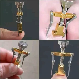 ارتدونسی ناخن پا