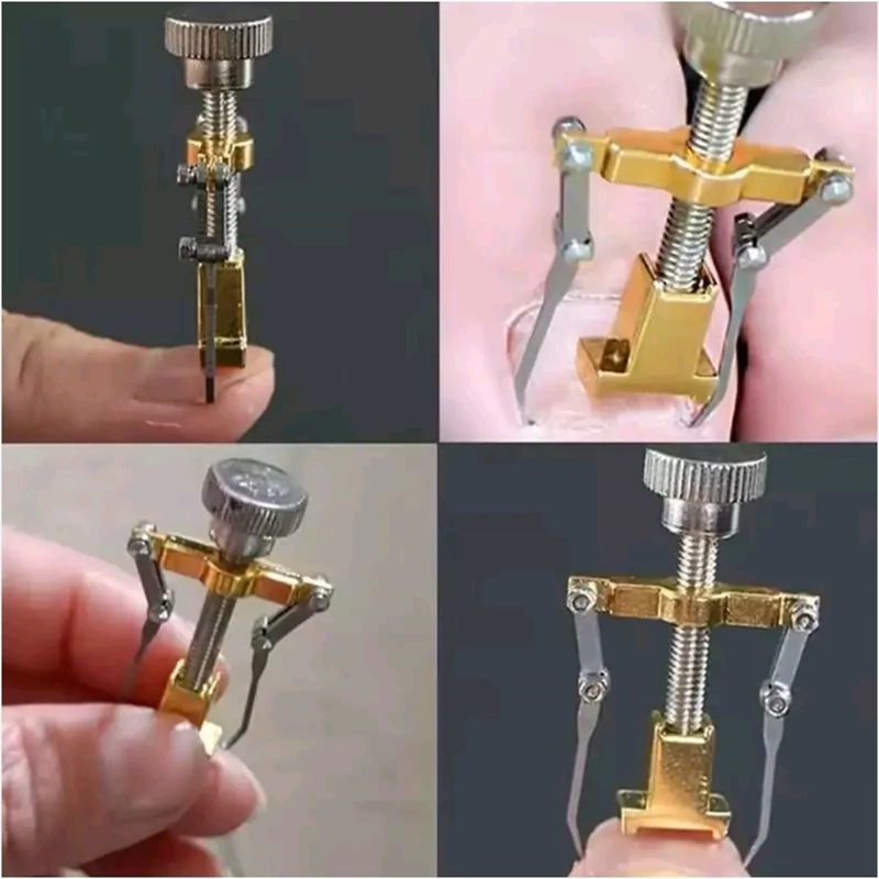 ارتدونسی ناخن پا - Image 2